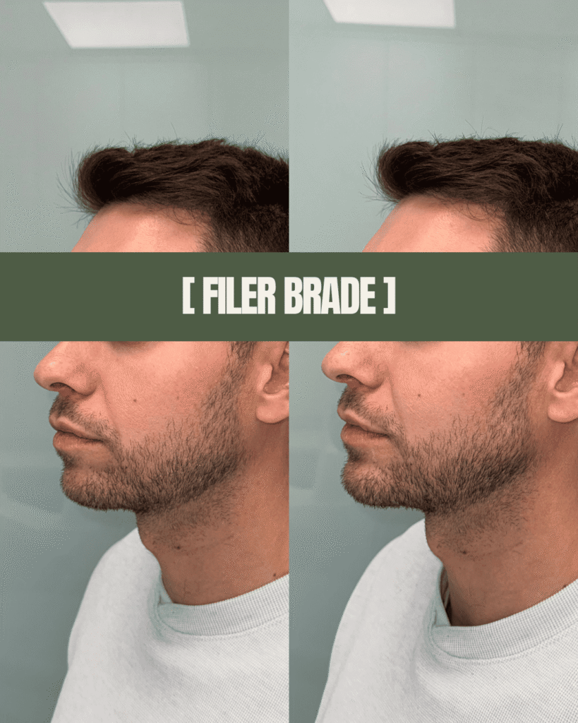 1point6_filler_polnilo_brada