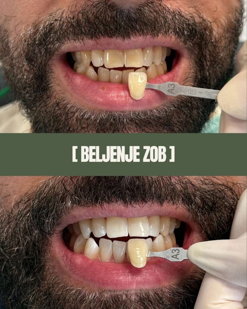 1point6 beljenje zob (2)
