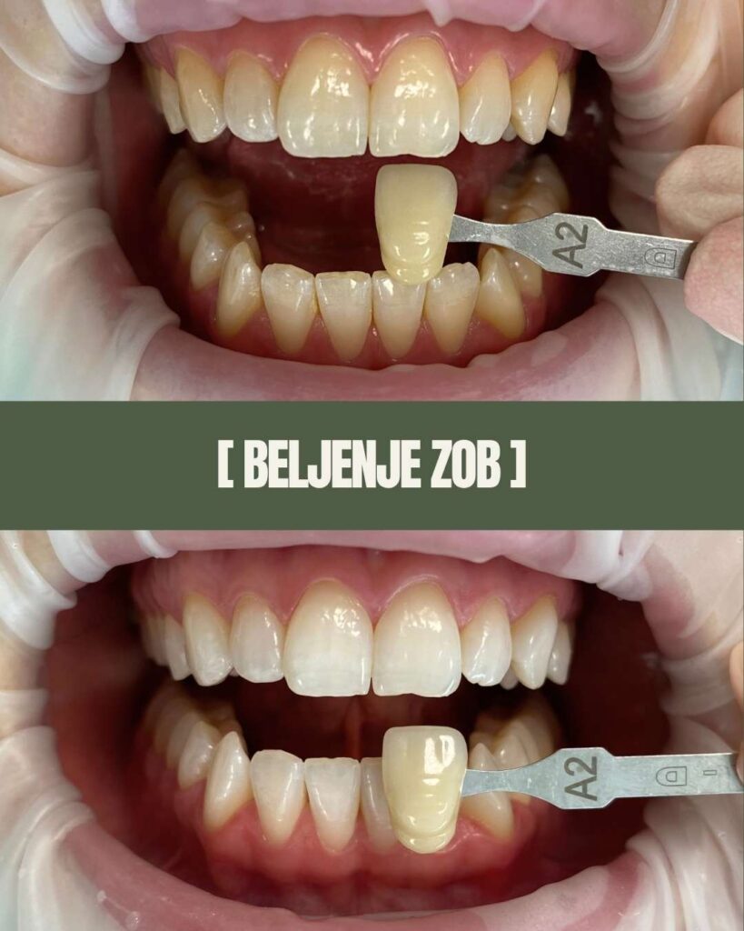 1point6 beljenje zob (3)