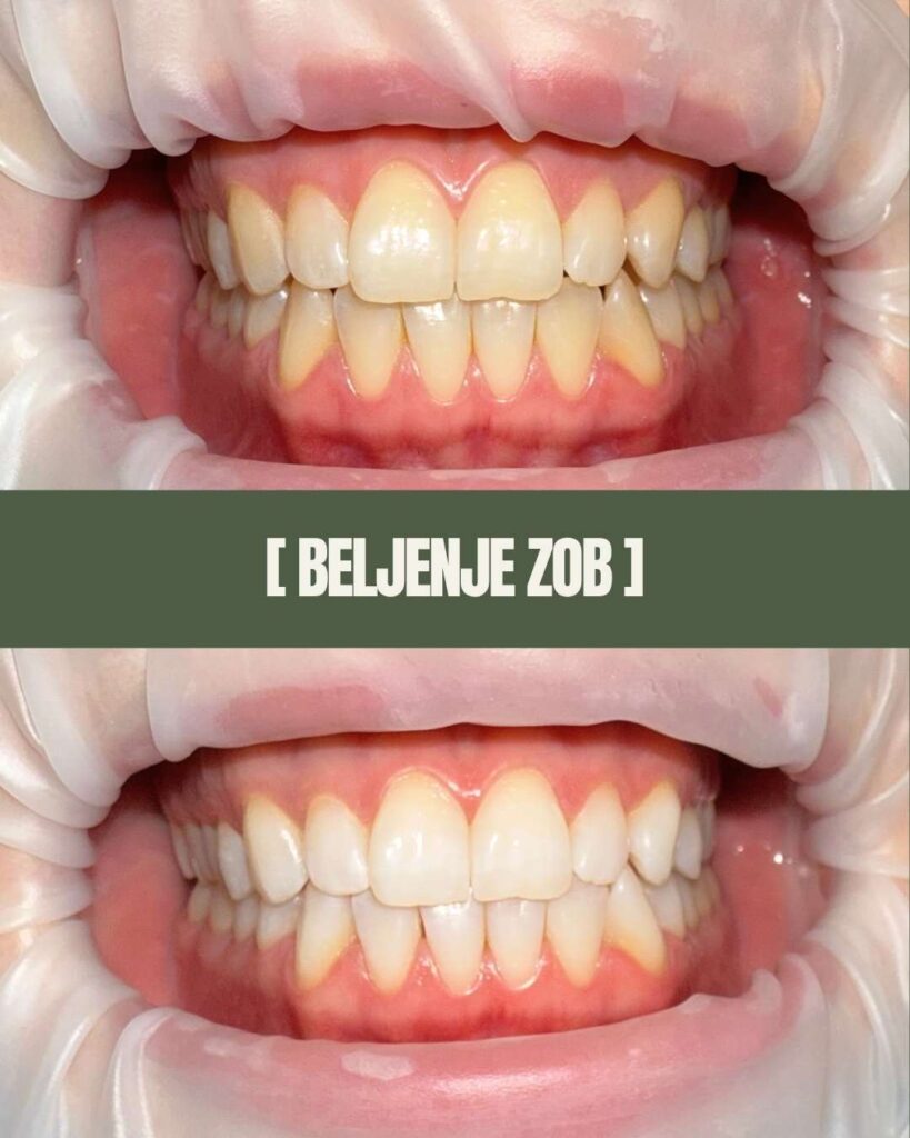 1point6 beljenje zob (4)