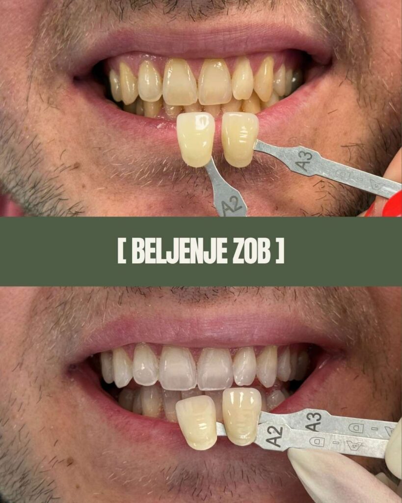 1point6 beljenje zob (5)
