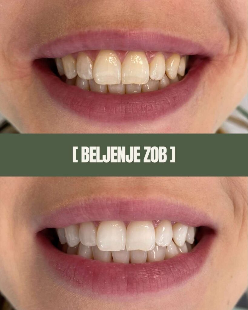 1point6 beljenje zob